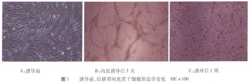 體檢中最易被忽視的第五“高”，竟是動脈硬化的元兇？(圖12)
